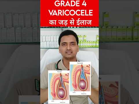 Varicocele homeopathic medicine in hindi | varicocele treatment without surgery |grade 4 varicocele