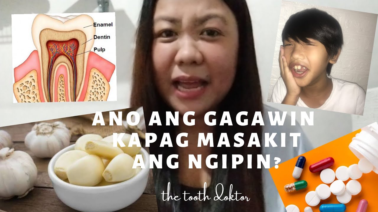 Ano Ang Gagawin Kapag Masakit Ang Ngipin | Gamot sa Sakit ng Ngipin: Home Remedy by Doc Krys 💙
