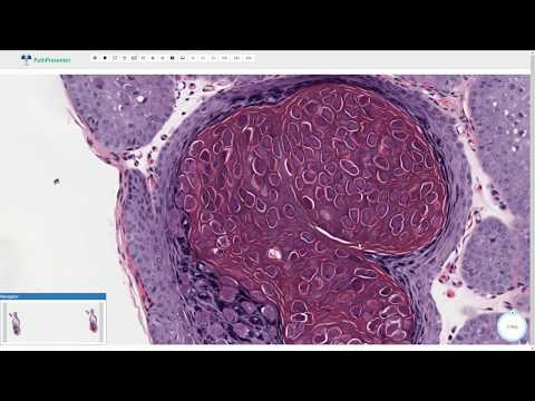 patogén szarvasmarha-papillomatosis könnyű féregdrogok