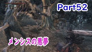 【メンシスの悪夢】Bloodborne【実況Part52】