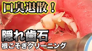 [問卦] 10年沒看牙醫 現在很緊張 怎辦