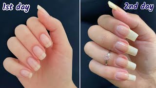 How to grow nails in 2 days || How to grow nails fast || How to grow nails fast overnight ||