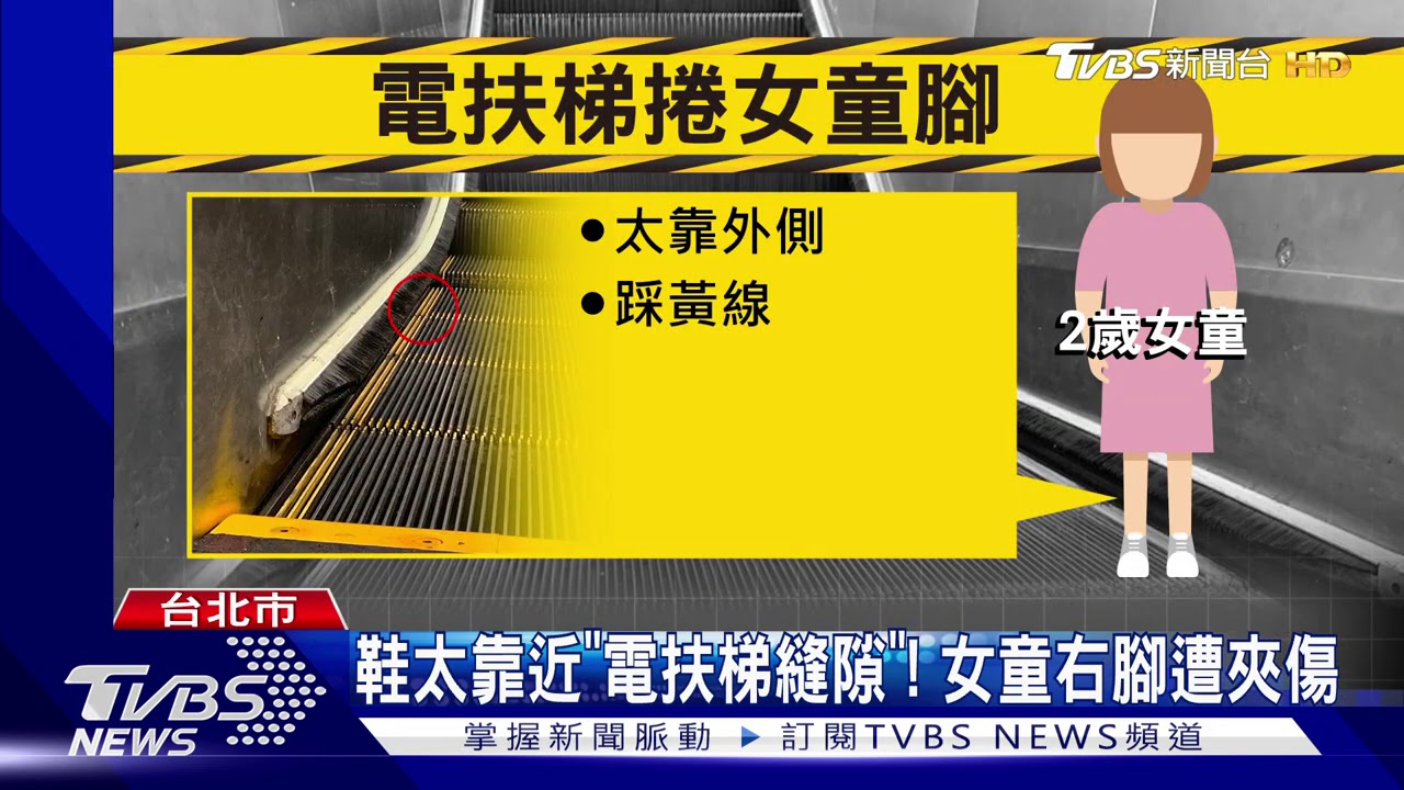 捷運電扶梯夾布希鞋! 2歲女童腳掌擦挫傷