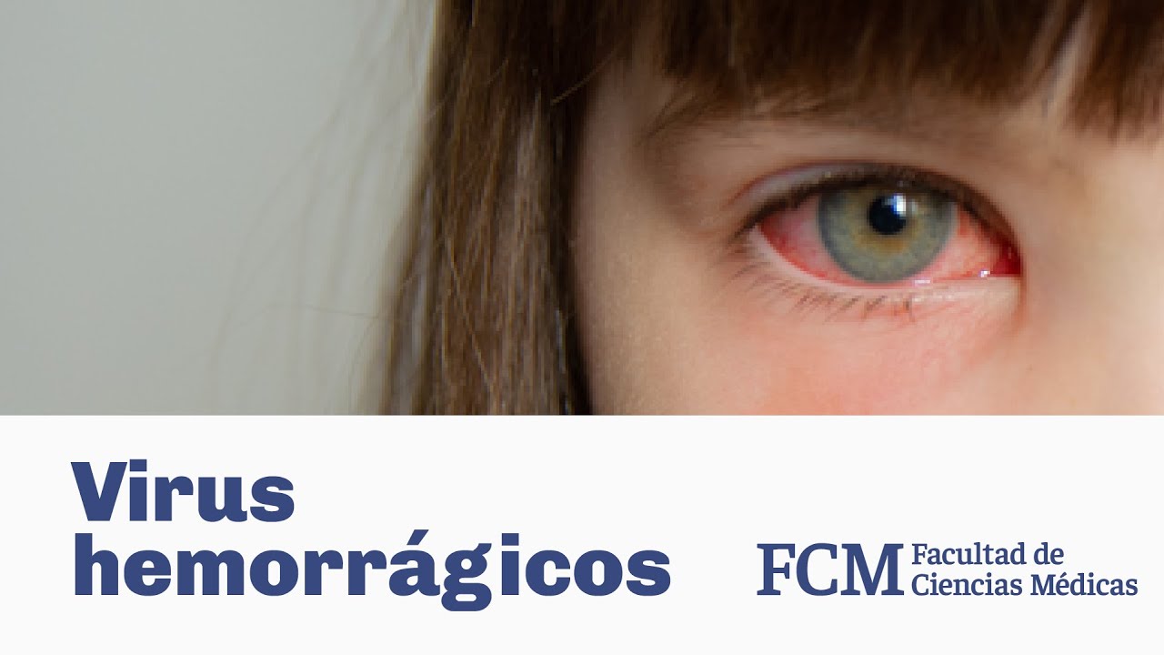 Virus Hemorrágicos