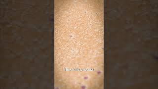 How An Epilator Works 🤔