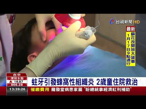 蛀牙引發蜂窩性組織炎2歲童住院救治