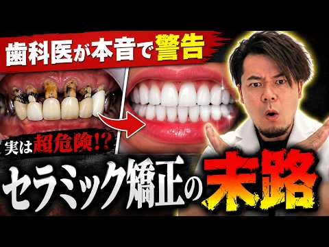 【歯科医が本音で警告】セラミック強制の末路