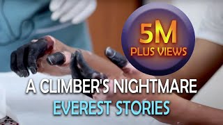 Frostbite - A Climber&#39;s Nightmare | Everest Stories
