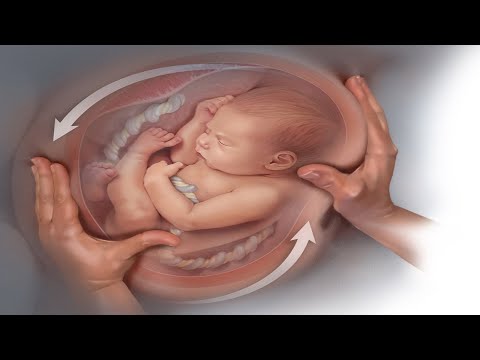 Best Sleeping Positions to Turn a Breech Baby Naturally At Home