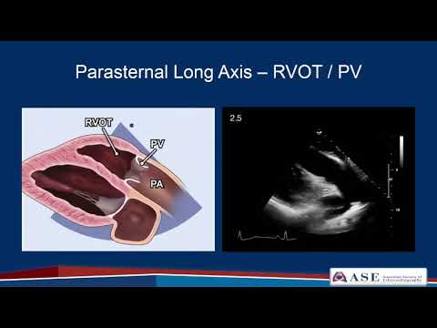 Part 2: Comprehensive TTE in Adults Webinar
