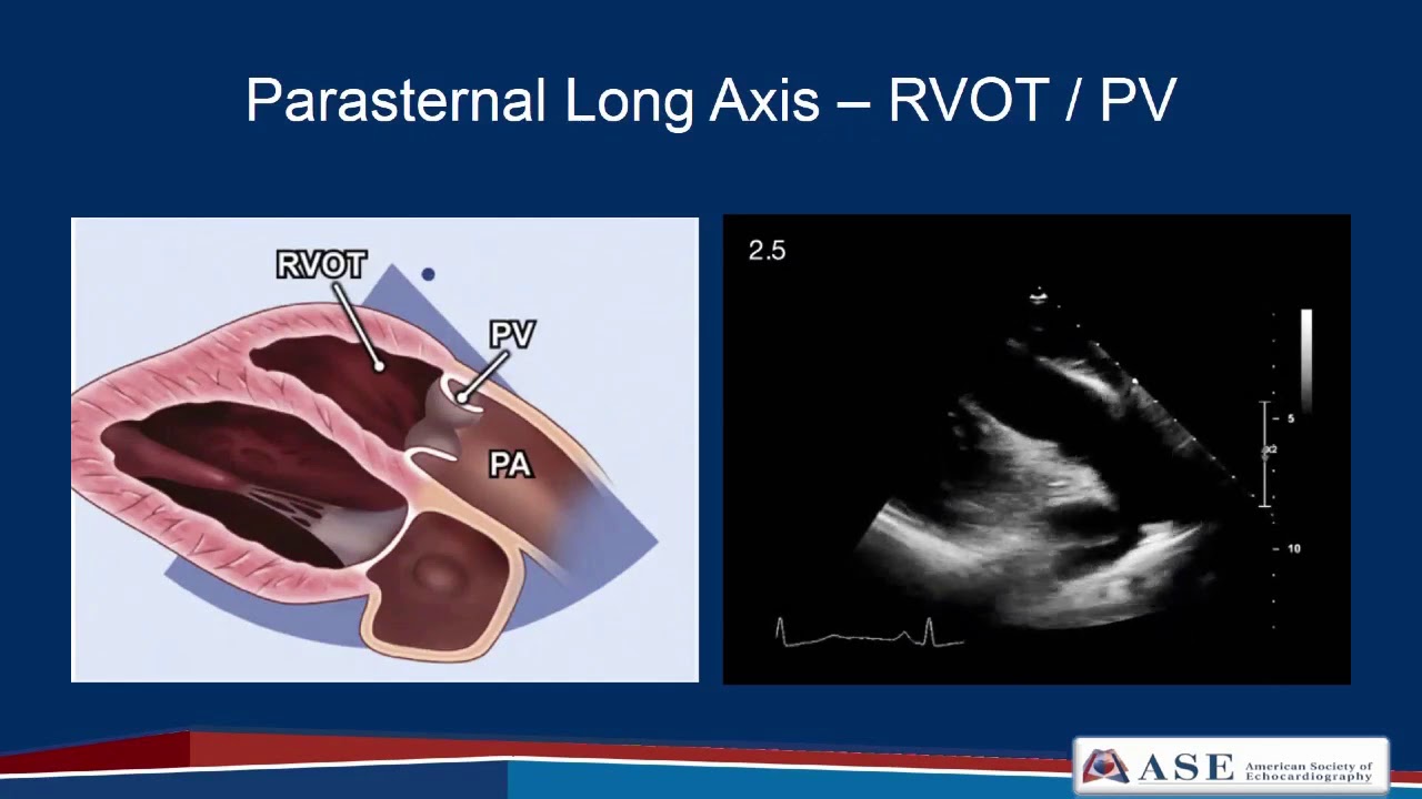 Part 2: Comprehensive TTE in Adults Webinar