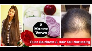 Home Remedy For Baldness & Hair Regrowth DIY|Sushmita's Diaries