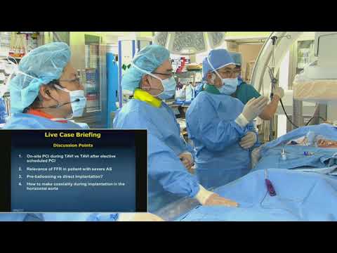 [TCTAP 2017] Valve Symposium - Live Case & Lecture Session II