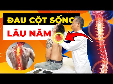 Đau Cột Sống Kéo Dài: Tại Sao Mọi Nỗ Lực Điều Trị Của Bạn Đều Thất Bại?
