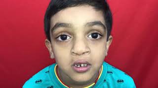 preview picture of video 'Bilateral cleft lip and palate - Before and After - long term results'