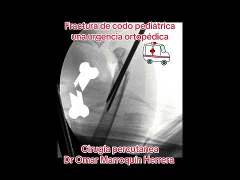 Omar Marroquín Herrera-89