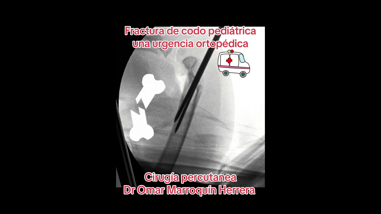 Omar Marroquín Herrera-89