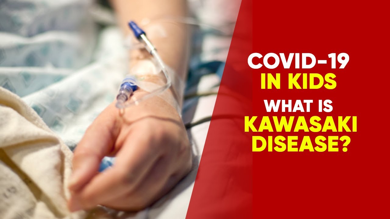 Kawasaki Syndrome: What Is This New Disease Detected In COVID-19 Recovered Children? | NewsMo