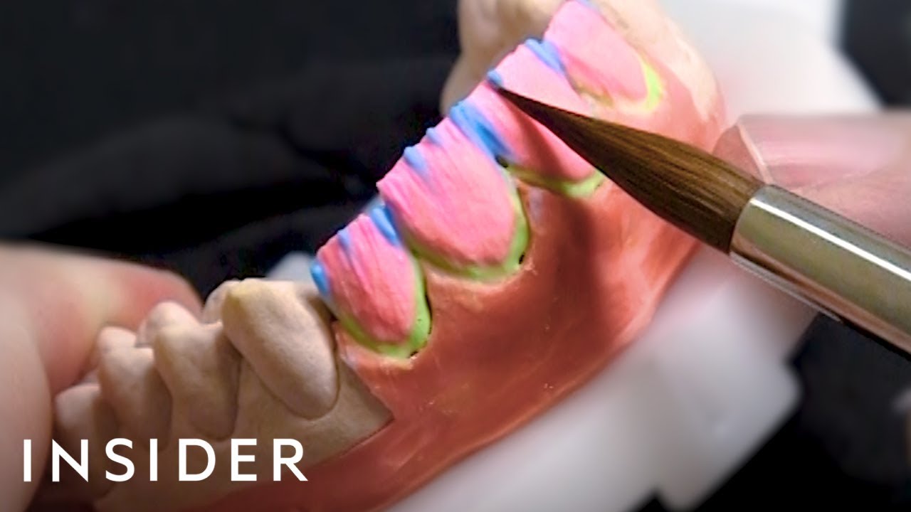 How This Dentist Crafts $80,000 Veneers For Celebrities | Beauty Explorers