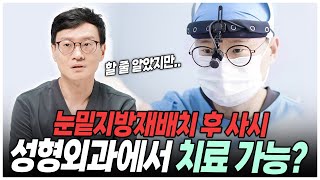 "눈밑지"로 사시가 될 가능성➕사시 고칠 가능성=❓