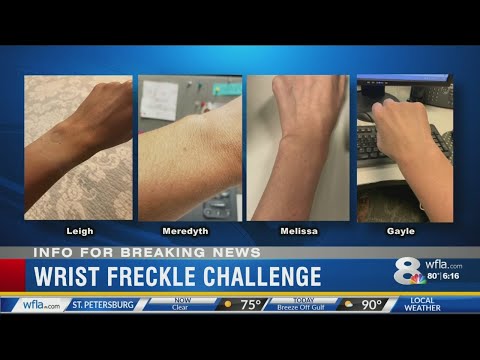 Women sharing photos of the same freckle on their wrist goes viral