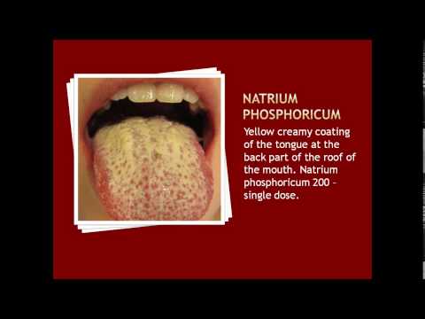 Kung paano sa paggamot sa kuko sawn Ointments at gels mula sa kuko halamang-singaw paggamot