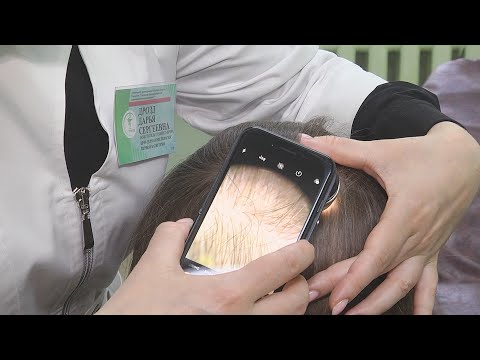 Патологическое выпадение волос после COVID-19. Что делать? видео