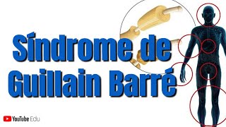 Síndrome de Guillain Barré (Subtipos, Quadro Clínico e Fases)