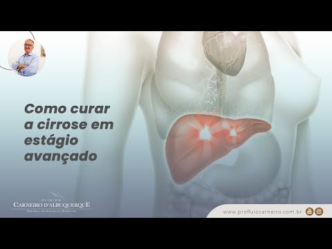 How to cure advanced cirrhosis | Prof. Dr. Luiz Carneiro CRM 22761