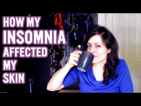 My Insomnia | Insomnia Effects.....| SimpleCareSteph Video