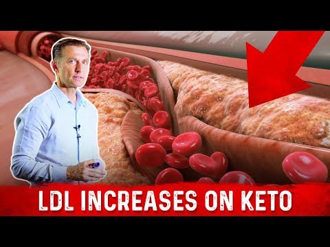 Cardiologist (Dr. Nadir Ali) Explains LDL Bad Cholesterol Spike With Keto – Dr.Berg