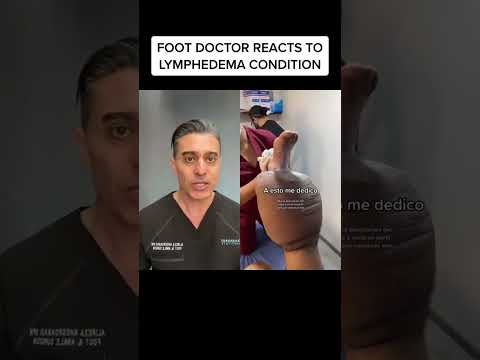 Lymphedema does WHAT to your leg?!?