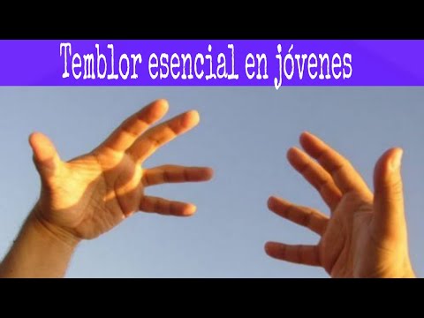 download lagu mp3 mp4 Me Tiemblan Las Manos, download lagu Me Tiemblan Las Manos gratis, unduh video klip Me Tiemblan Las Manos