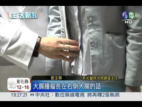 連續腹瀉三天...29歲男子罹大腸癌