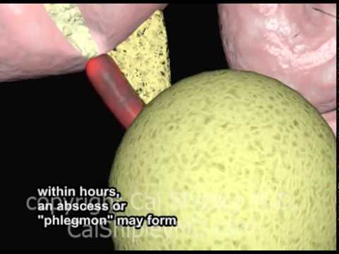 Mga produkto na naglalaman ng malalaking halaga ng protina para sa slimming Reduxine sa parmasya presyo EuroPharm