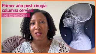 UN AÑO DESPUÉS DE CIRUGÍA EN COLUMNA CERVICAL | Hernia C5-C6