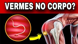 7 SINAIS de que seu corpo está CHEIO de VERMES! Sintomas URGENTES de Parasitose Intestinal