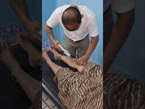knee patella pain treatment for cupping therapy