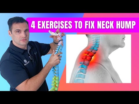 Fix The Bone Sticking Out On The Back Of Neck