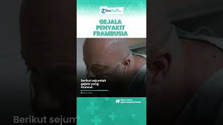 Kenali Gejala Penyakit Frambusia yang Bisa Infeksi Kulit hingga Sendi