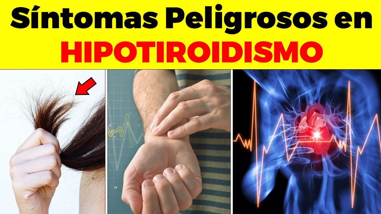 REVELADO! 10 Síntomas Peligrosos EN HIPOTIROIDISMO - Urgencias en hipotiroidismo
