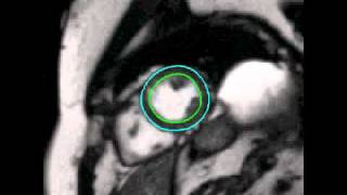 Comprehensive Segmentation of Cine Cardiac MR Images