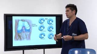 Los buenos Años 8 CAUSAS DE RUIDO EN LA RODILLA CORREGIDO