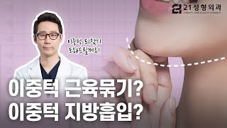 [이중턱근육묶기] 이중턱근육묶기란 무엇인가요??  [21성형외과]
