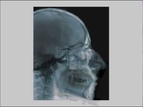 Dolore alla schiena dà il basso addome Malattie delle articolazioni del piede delle dita