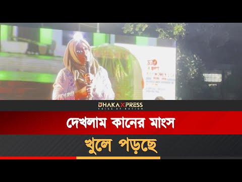 দেখলাম কানের মাংস খুলে পড়ছে