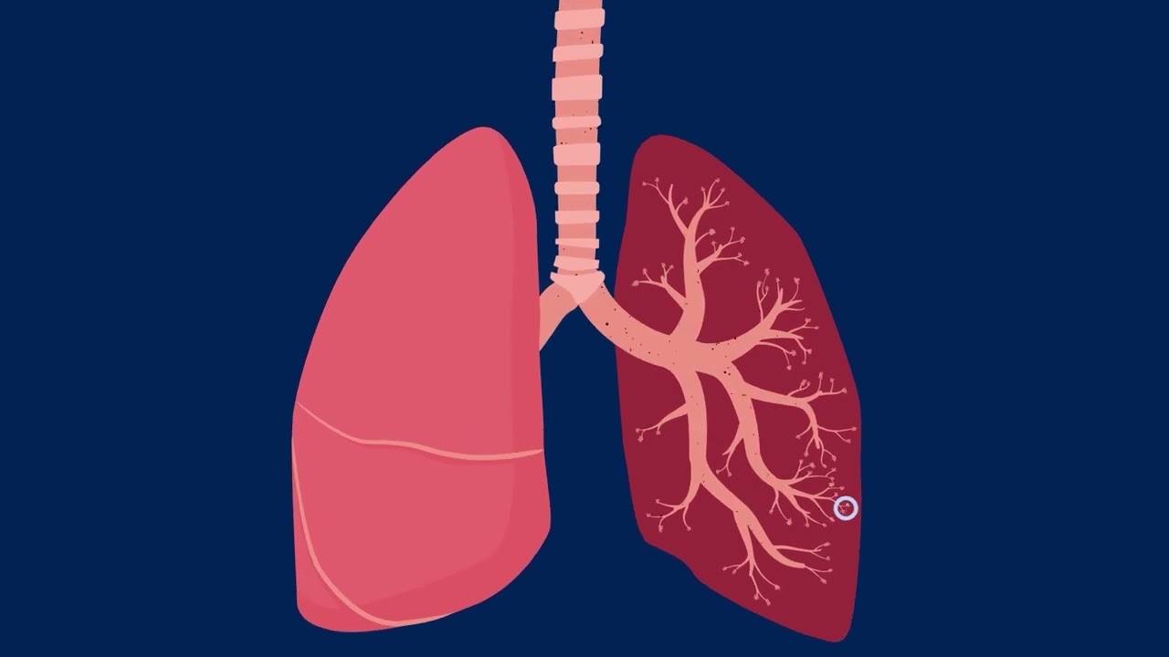 How Particle Pollution Impacts Your Lungs
