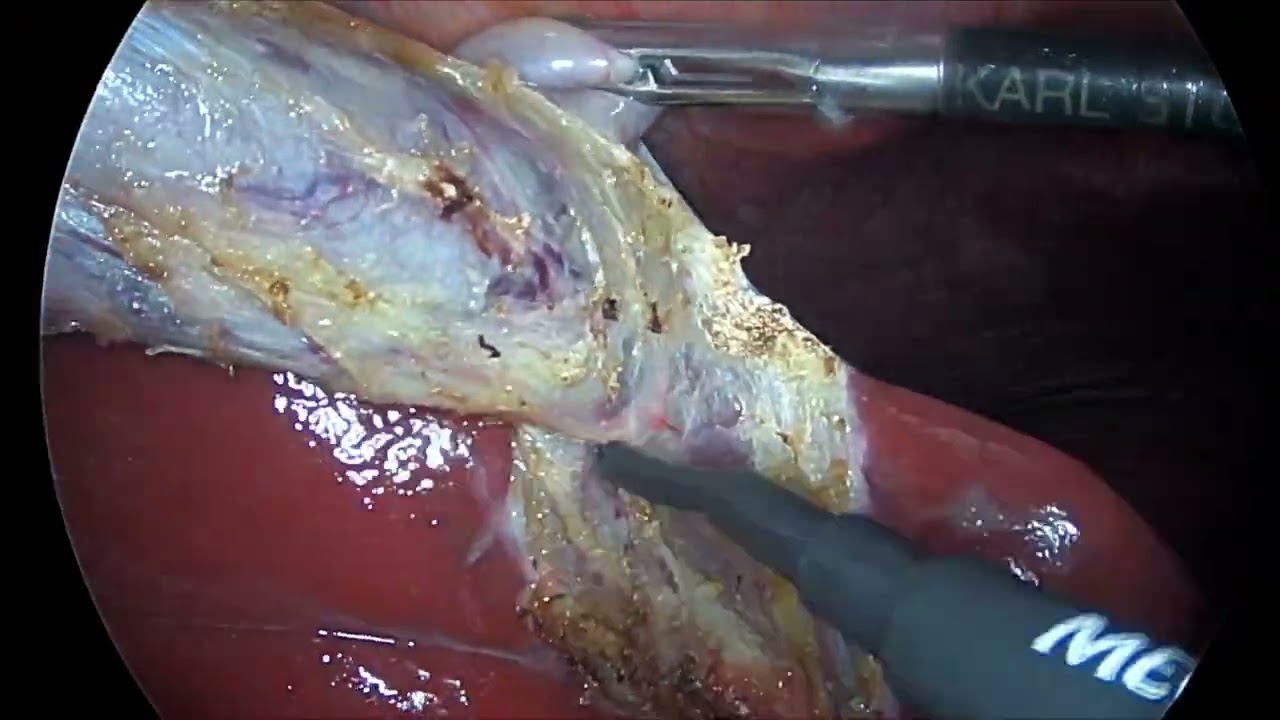 Juan Orlando Guaman-6