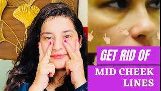 Get rid of mid cheek lines & laugh lines | Facial exercises to look younger | Rachna Jintaa|