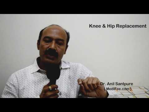 download lagu mp3 mp4 Hip Replacement Surgery Cost In India, download lagu Hip Replacement Surgery Cost In India gratis, unduh video klip Hip Replacement Surgery Cost In India